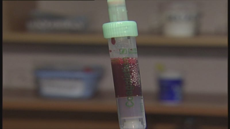 Zloděj v Praze bodl člena ochranky injekční stříkačkou. Je nakažená žloutenkou, varoval